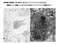 豚肝臓の尿細管上皮の核内に見られたアデノウイルスによる封入体
