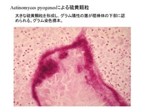 Actinomyces pyogenes