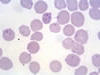 血液塗沫像、赤血球に多数のエペリスロゾーンが寄生。