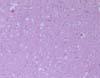 延髄(閂部)、三叉神経脊髄路核。神経網(ニューロピル)の空胞化がみられる。 HE染色、x200。