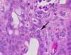 粘膜上皮細胞内のミクロガモント 小腸、HE染色、x1000