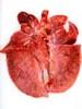 肺水腫(小葉間結合組織の拡張が顕著である)。
