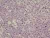 ファブリキウス嚢の腫瘍増殖。腫瘍は均一なリンパ芽球の増殖からなる。 HE染色、x100。