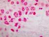 病巣内にグラム陽性小桿菌がみられる。 延髄、グラム染色、x1000