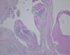 リンパ球浸潤を伴った滑膜の絨毛状増殖。 HE染色、x40。