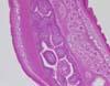 結腸腔内の鞭虫の縦断面、拡大像。