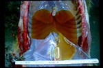 感染死亡馬の胸腔（胸水の顕著な貯留）（原図：JRA総研栃木支所）