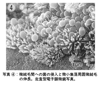 写真4 微絨毛間への菌の侵入と微小集落周囲微絨毛の伸長
