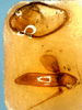 Dorsal