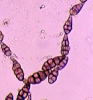 アルタナリア菌の鎖生分生子