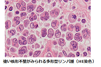 強い核形不整がみられる多形型リンパ腫(HE染色)