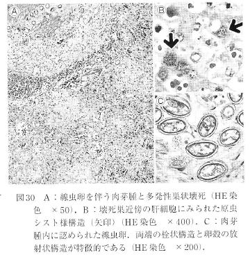 e̊̑ɂ݂ꂽgL\vY}ɂ鑽󎀂ъ̖эאɂ鑽