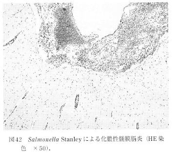 Salmonella Stanleyɂ鉻^]