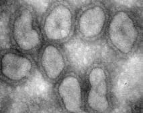 ニューカッスル病ウイルスの電子顕微鏡写真