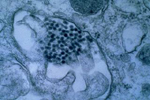 豚腎培養細胞で増殖した日本脳炎ウイルス粒子
