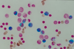 発症馬の末梢血の担鉄細胞（原図：JRA総研栃木支所）